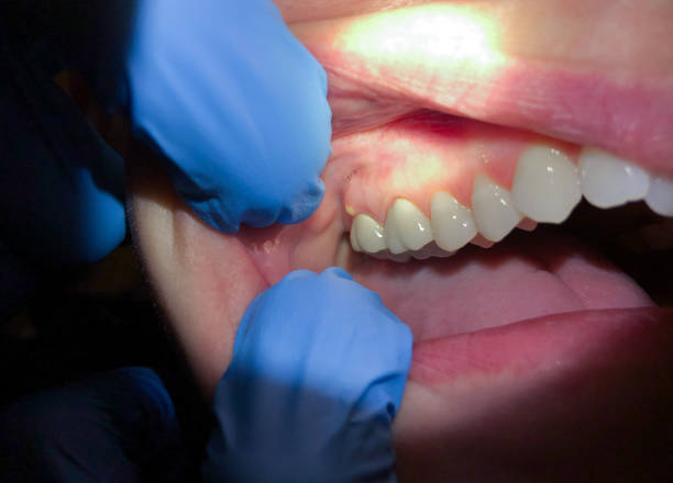 Best Emergency Orthodontic Repairs in Nahunta, GA