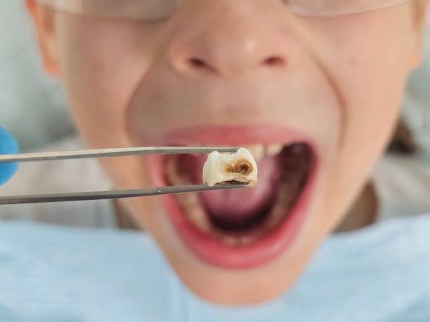 Best After-Hours Emergency Dentist in Nahunta, GA